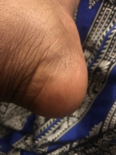 Customer photo review of Respected Roots Body Butter (Original Scent 8oz)
