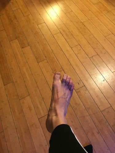 Customer photo review of BotaHälen™ Plantar Fasciit Lättnad Balsam