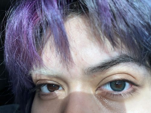 Customer photo review of Dark Ocean Contact Lenses(12 months of use)