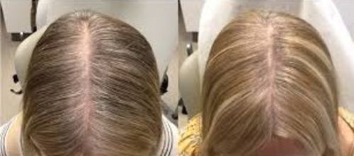 Customer photo review of Anti-Hair Loss With Argan Oil - 10 Minute Miracle - Essential Bundle