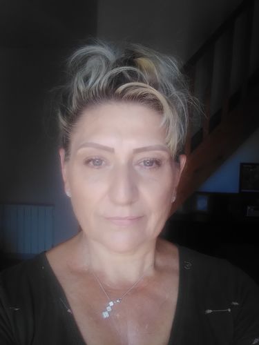 Customer photo review of ELMW – Sérum à l'acide hyaluronique pour le Visage, Original
