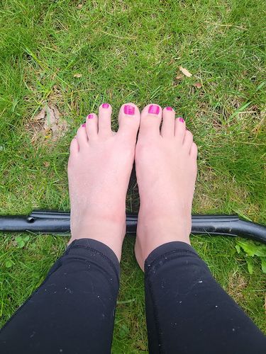 Customer photo review of DiabetiskLättnad™ Fotkräm
