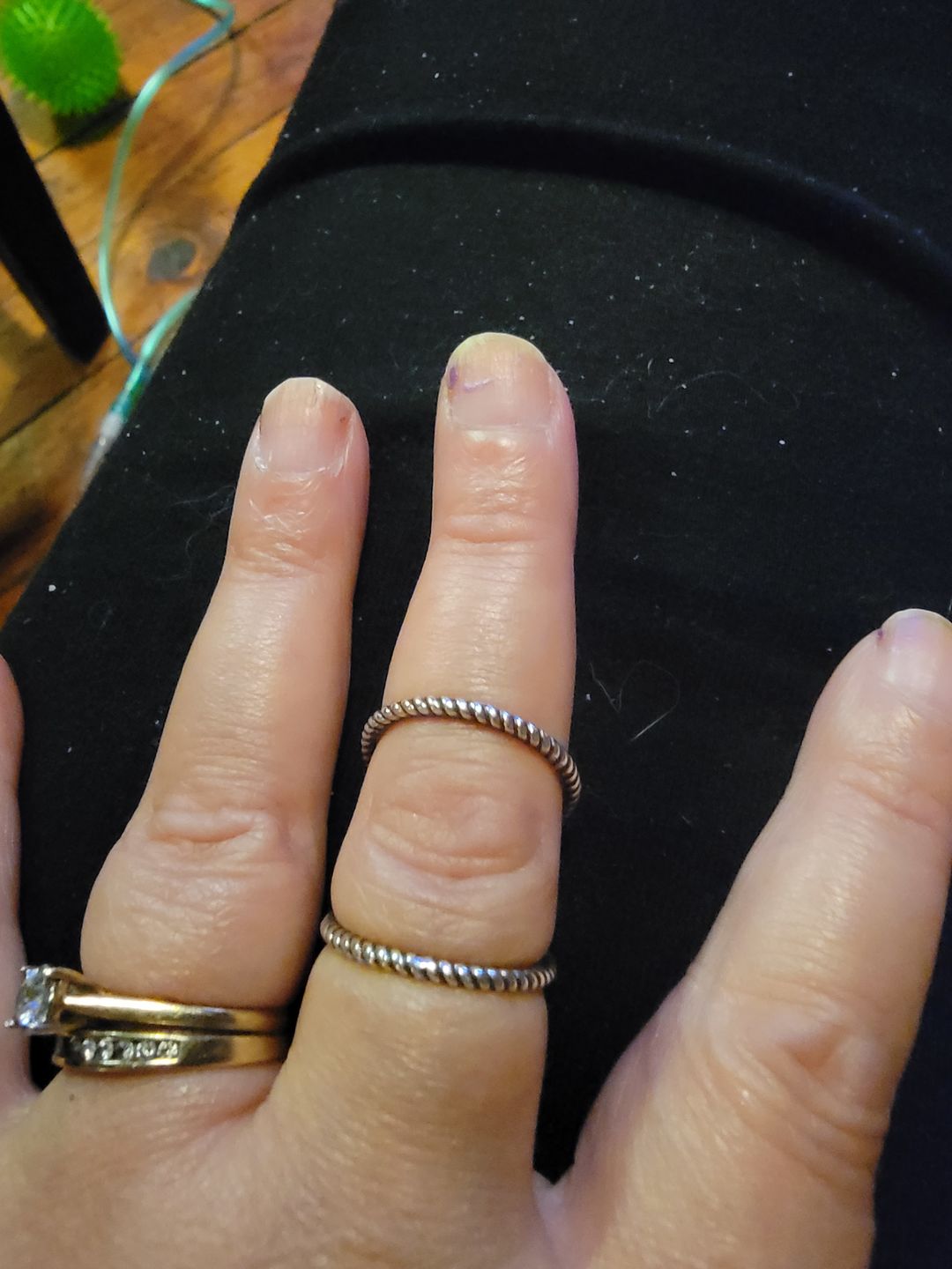 Customer photo review of Splint Knuckle Ring Sterling Silver