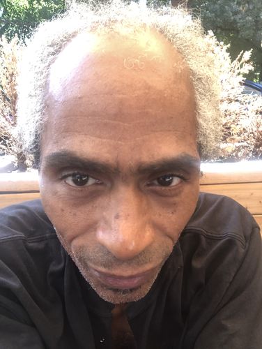 Customer photo review of India’s Secret Ancient Ayurvedic Hair Follicle Elixir (4 sizes)