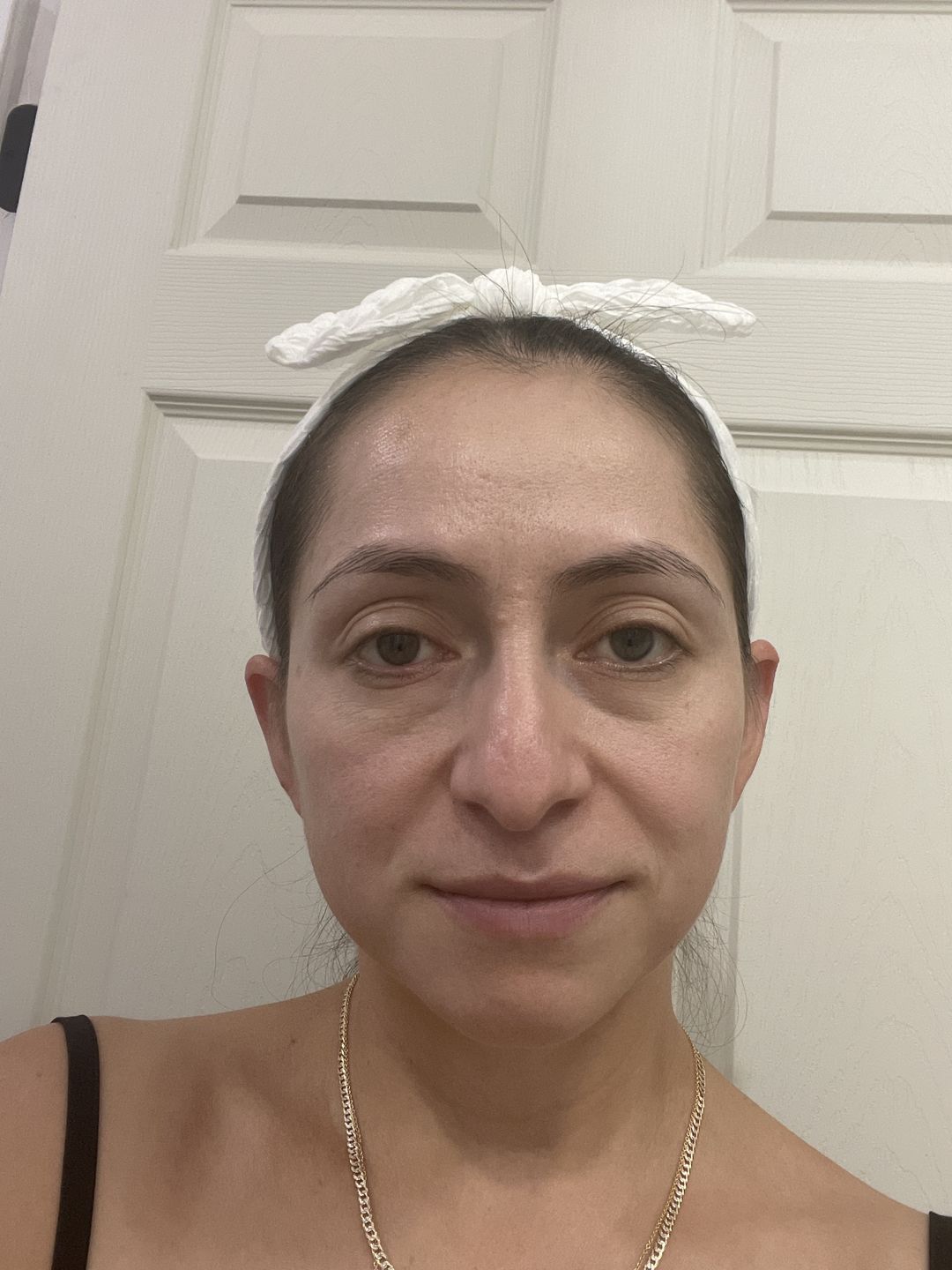 Customer photo review of Juveness Plus Bright Lift