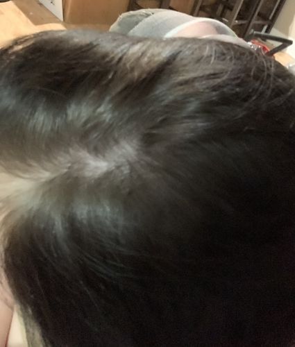 Customer photo review of Growth & Shine Hair Oil