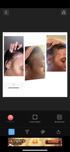 Customer photo review of Hair Growth Potion