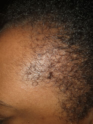 Customer photo review of Pro Bundle