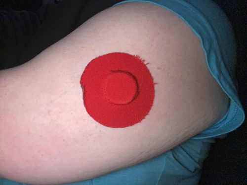 Customer photo review of Skin Grip Original - Freestyle Libre Adhesive Patches