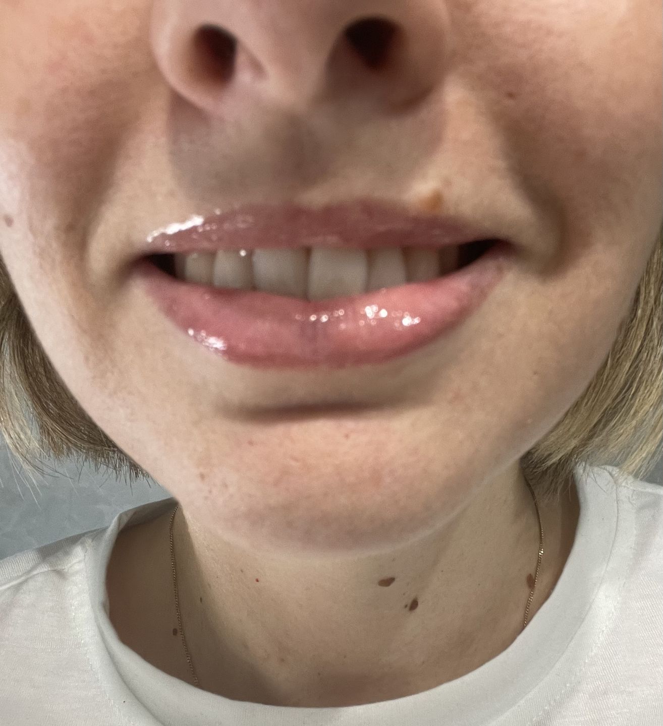 Customer photo review of LIP OIL CUTE LIPPY