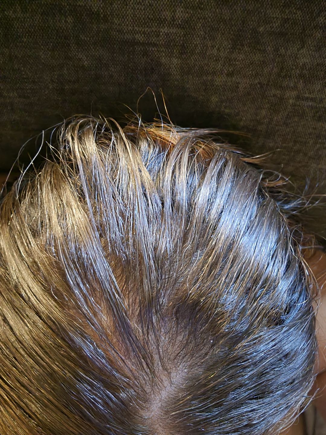 Customer photo review of "I AM" Levonye laser chateau-cap