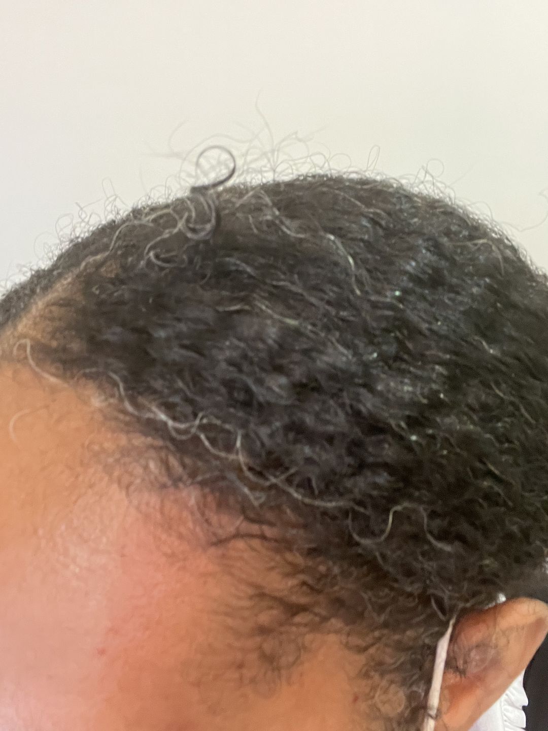Customer photo review of HAIR SHED VOLUMIZING ROOT SPREAD Tea Spritzer/Herbal Leave-in