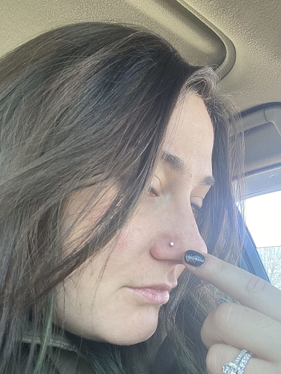 Customer photo review of Piercing Aftercare Swabs