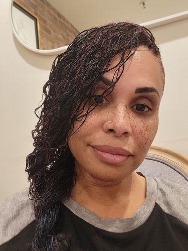 Customer photo review of SkinFix: Morpheus8