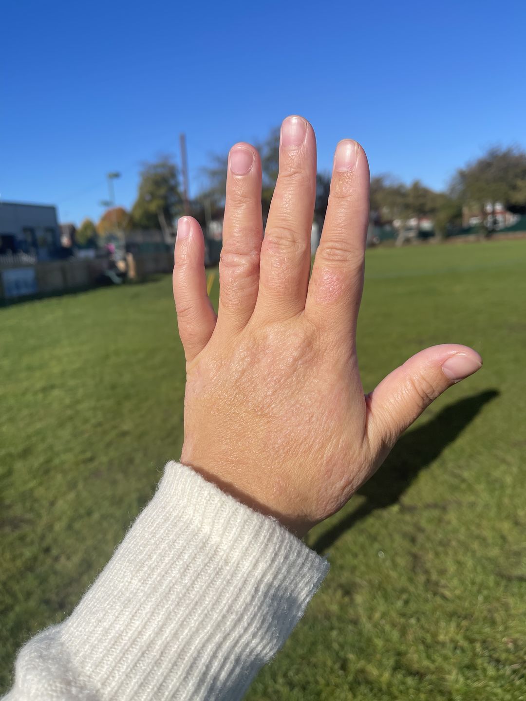Customer photo review of Bioskin Zeoderm Skin Repair Moisturiser