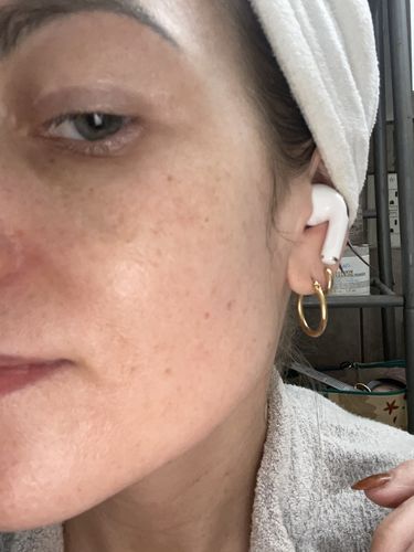 Customer photo review of EyeFix: Filler