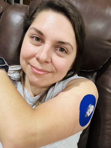 Customer photo review of Skin Grip Dexcom G6 Patches