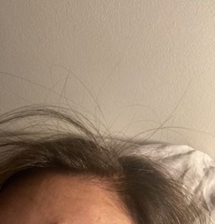 Customer photo review of Shampoo Anticaída