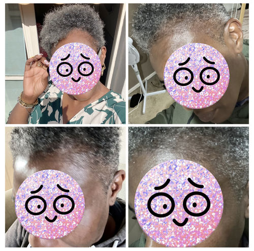 Customer photo review of Inches Pro