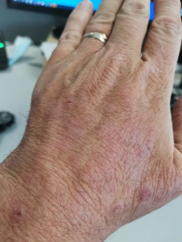 Customer photo review of Healing Balm (35ml)