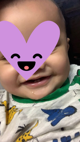 Customer photo review of Jolicare Cream