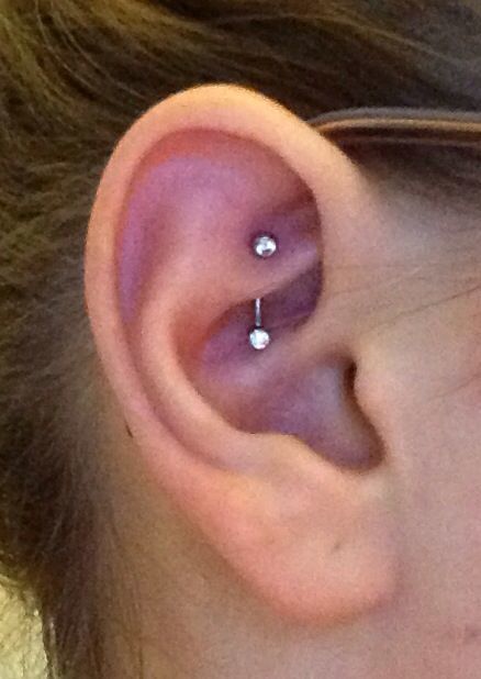 Customer photo review of Piercing Aftercare Keloid Crasher Kit