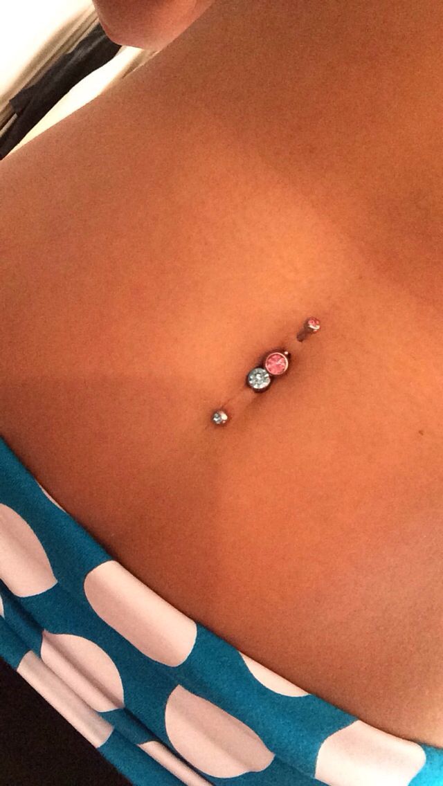 Customer photo review of Piercing Aftercare Keloid Crasher Kit