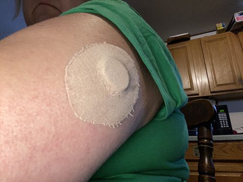 Customer photo review of Skin Tac Adhesive Barrier Wipes