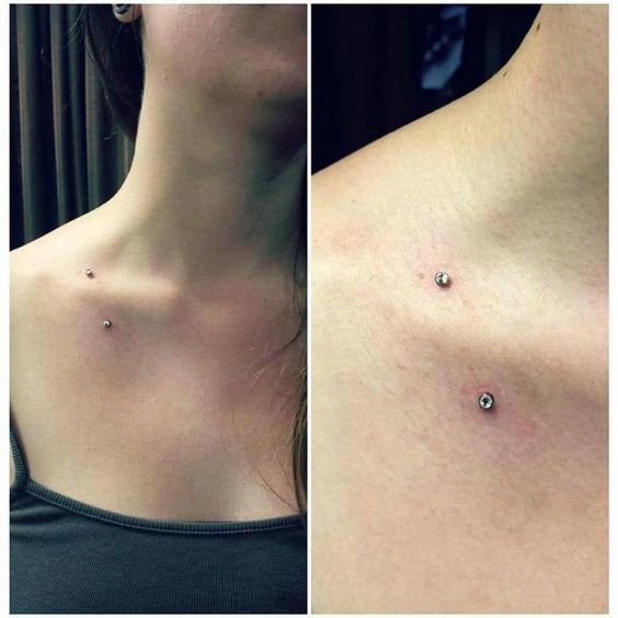 Customer photo review of Piercing Aftercare Keloid Crasher Kit