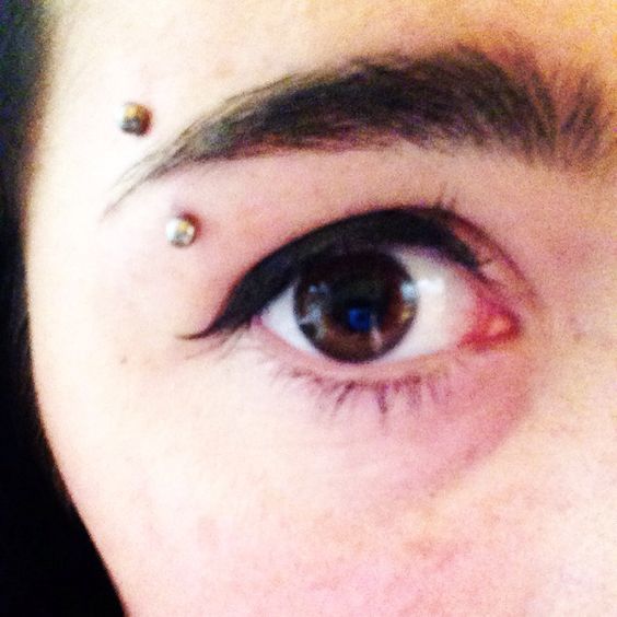 Customer photo review of Piercing Aftercare Keloid Crasher Kit