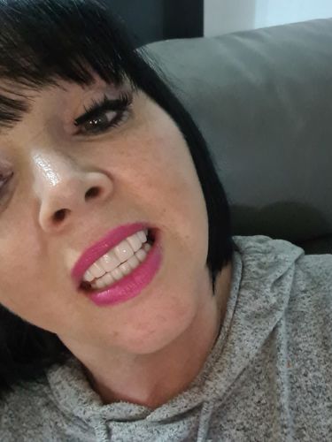 Customer photo review of Teeth-Veneer 2.0