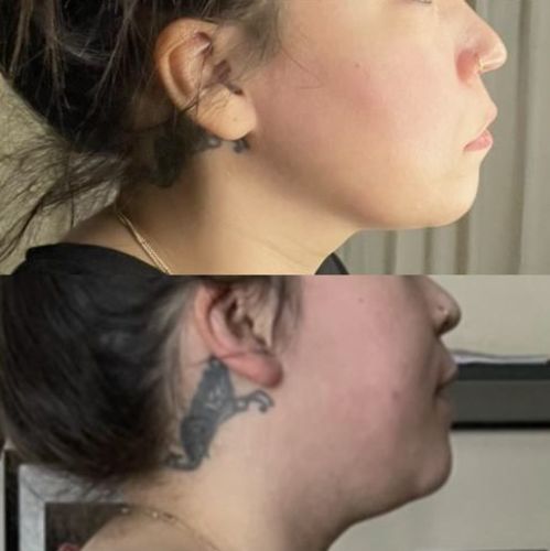 Customer photo review of Naked Skin™ Handset