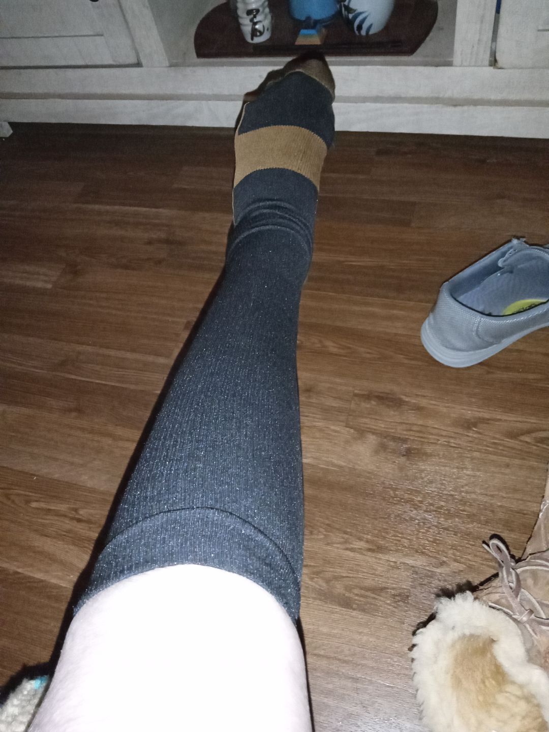 Customer photo review of Copper Compression Socks (3-Pack)