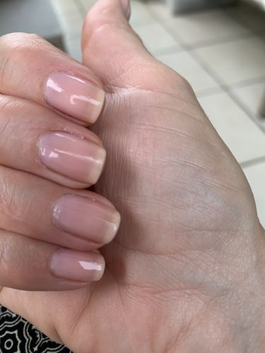 Customer photo review of Glow + Grow Hair Growth Collagen Starter Kit