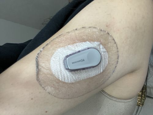 Customer photo review of Skin Tac Adhesive Barrier Wipes