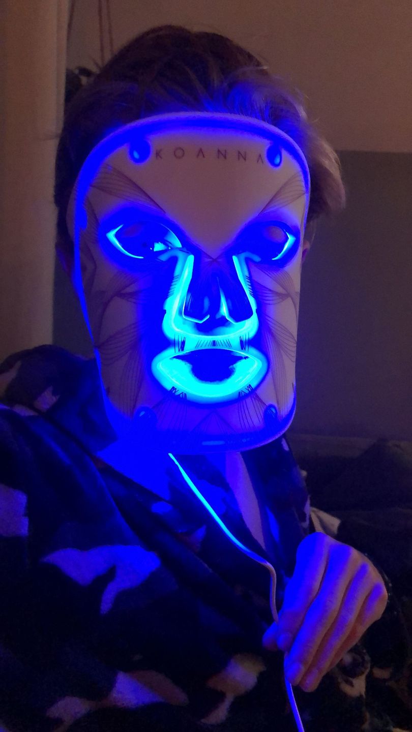 Customer photo review of LED Light Therapy Mask