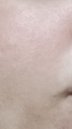 Customer photo review of Anti-Aging - Super Activs Skin Serum
