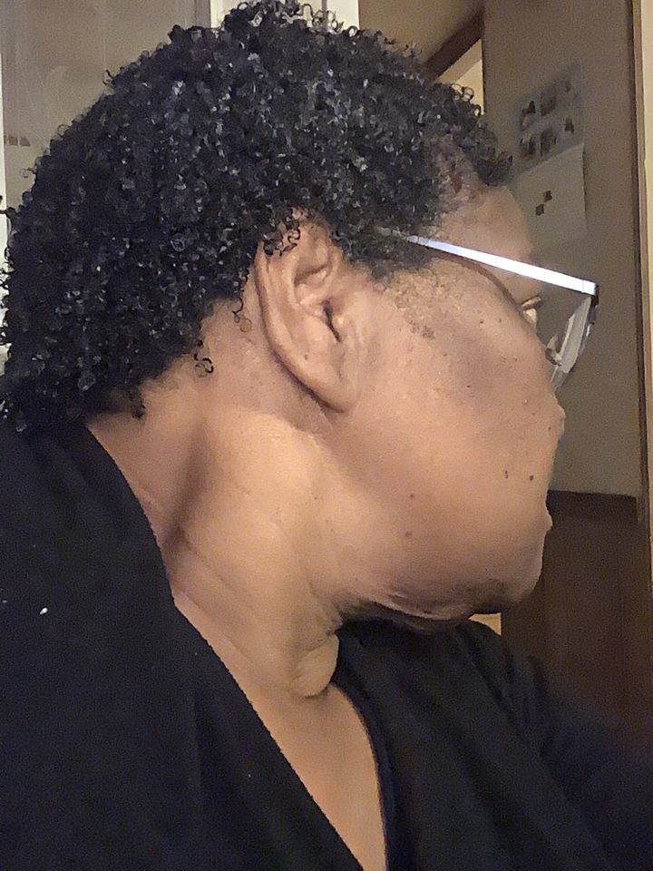 Customer photo review of Hair Growth Serum for Curly Hair with Organic Jojoba Oil for Moisturizing and Lavender Fragrance