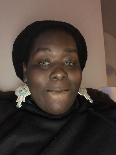 Customer photo review of Moira Green Contact Lenses(12 months wear)