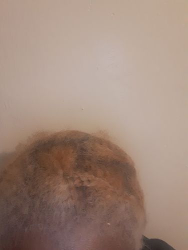 Customer photo review of [Step 6] HAIR BOOST: Nae Nae's Flagship Product