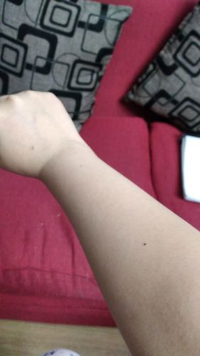 Customer photo review of Depilador Nuva Skin®