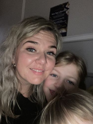 Customer photo review of Rosalique 3 in 1 Anti-Redness Miracle Formula SPF50