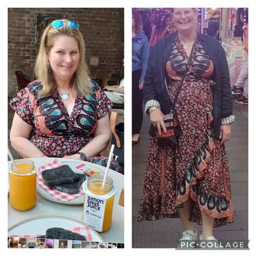 Customer photo review of Tanae Dress