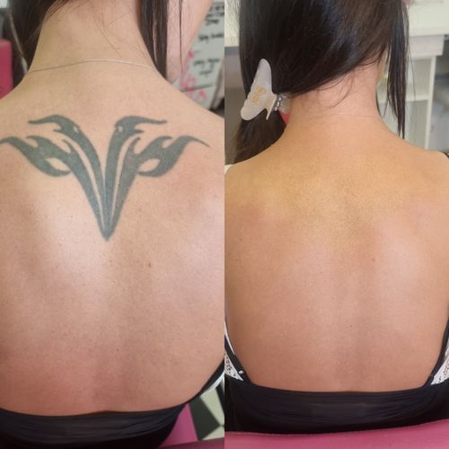 Customer photo review of Jordane Cosmetics - MINI Total Tattoo Cover Palette Fleshtone