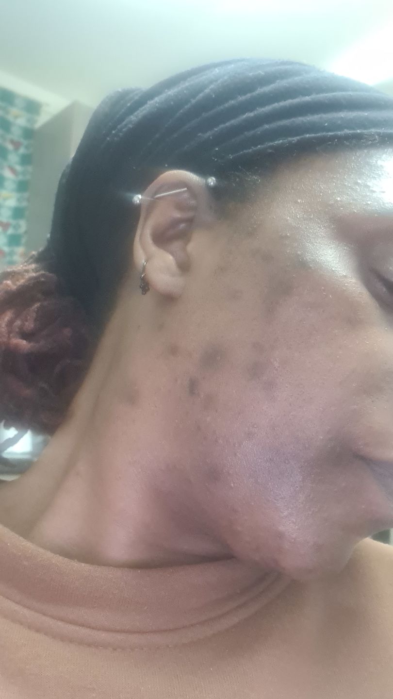 Customer photo review of Hair Growth Oil