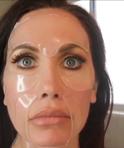 Customer photo review of Patchs Visage Anti-Rides Fontanay™ Réutilisables