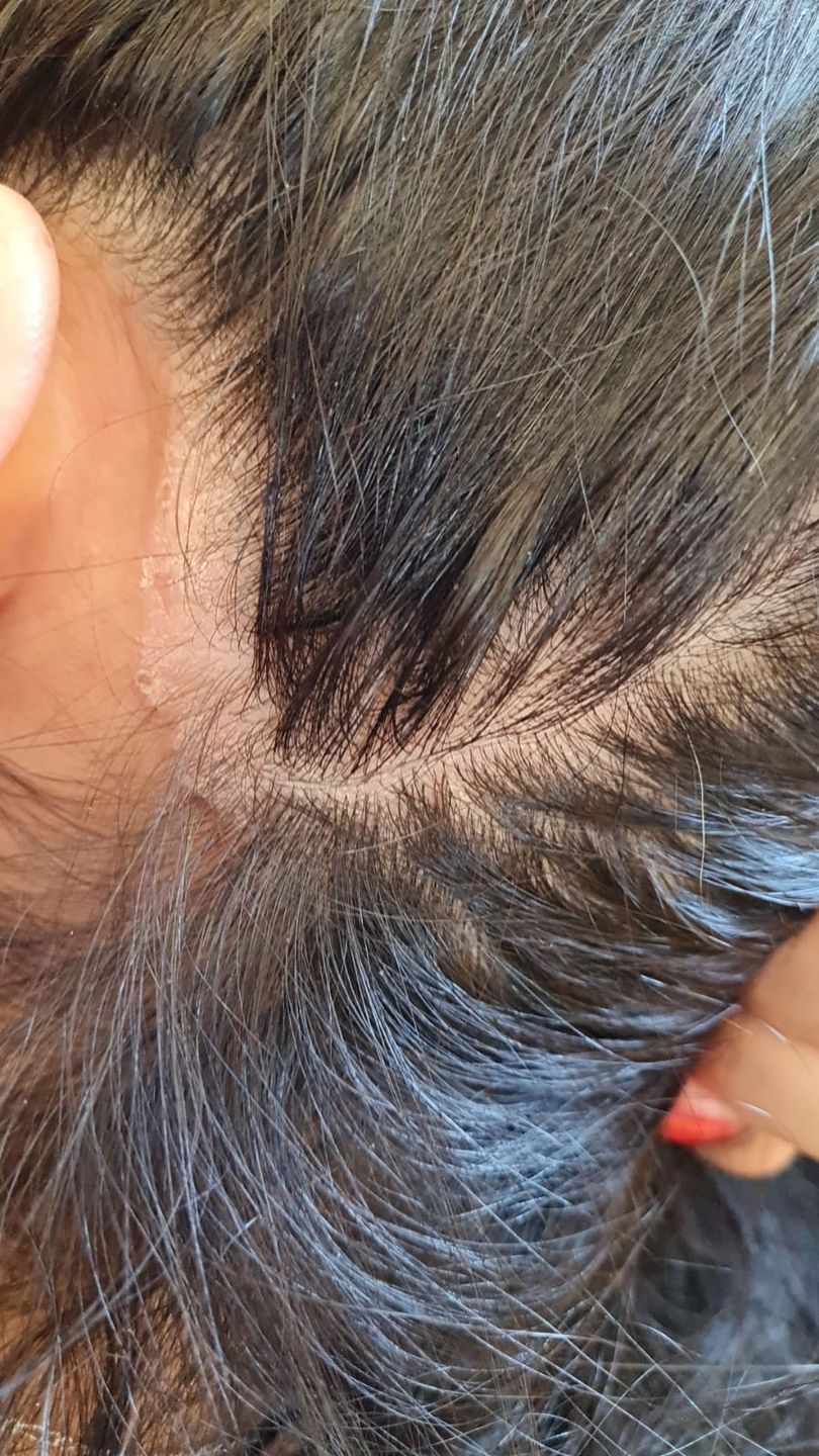 Customer photo review of SHAMPOO ANTICASPA GRASA FORMATO BARRA