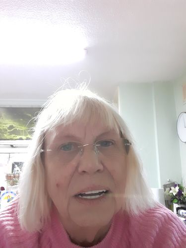 Customer photo review of Teeth-Veneer 2.0