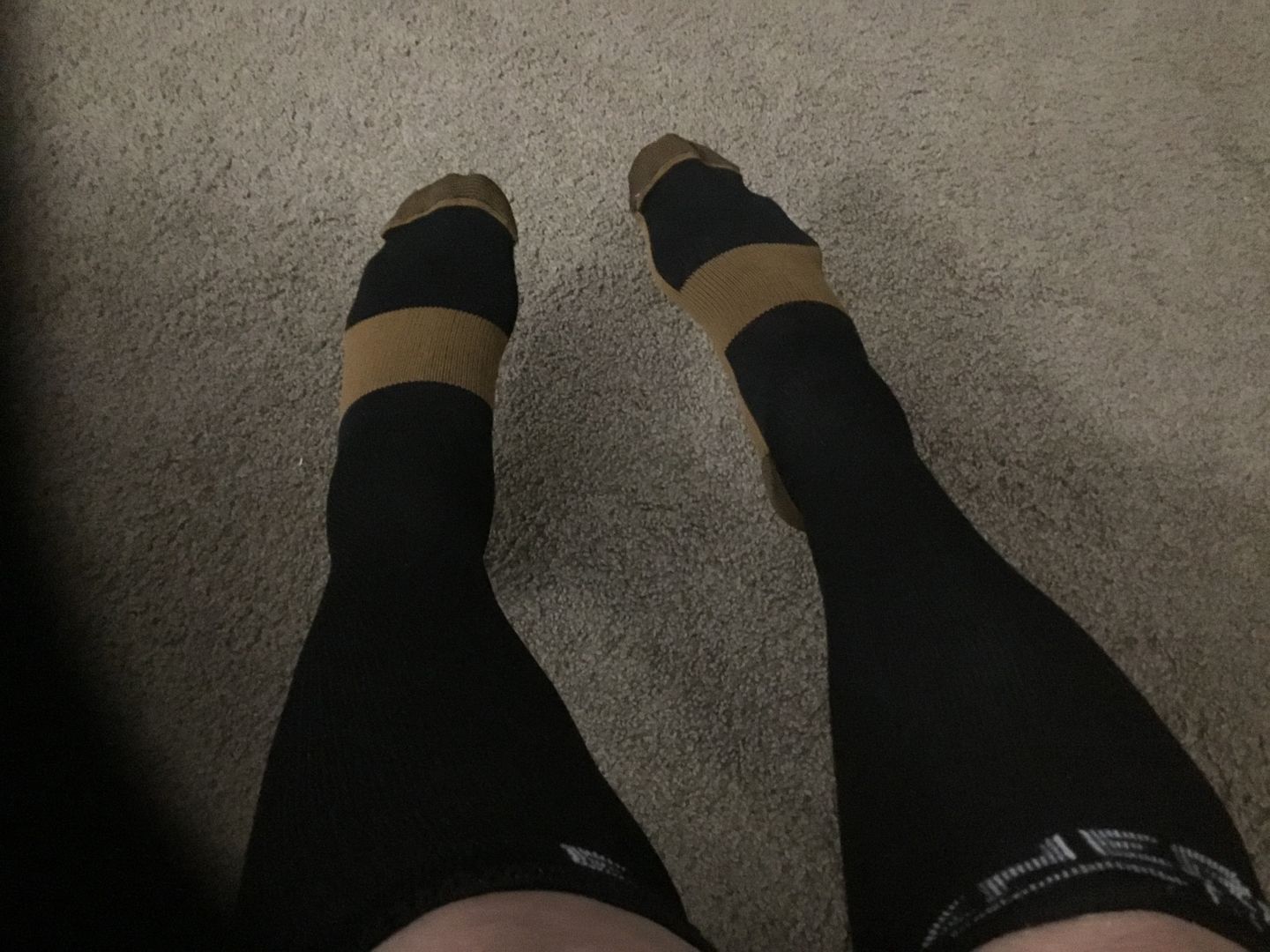 Customer photo review of Copper Compression Socks (3-Pack)