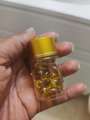 Customer photo review of The Big O Tightening Pops